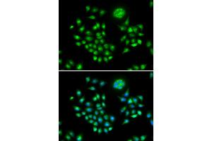 Immunofluorescence analysis of HeLa cells using AGFG1 antibody.