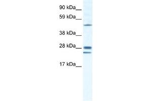 WB Suggested Anti-GJB2 Antibody Titration:  1. (GJB2 Antikörper  (Middle Region))