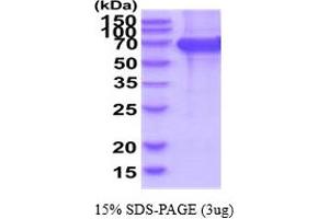 SDS-PAGE (SDS) image for EPH Receptor B2 (EPHB2) (AA 19-543) protein (His tag) (ABIN7281187) (EPH Receptor B2 Protein (EPHB2) (AA 19-543) (His tag))
