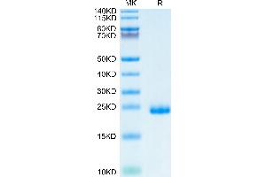 Human TIMP-2 on Tris-Bis PAGE under reduced condition. (TIMP2 Protein (His tag))