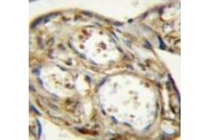 Immunohistochemistry analysis in human placenta tissue (Formalin-fixed, Paraffin-embedded) using DLK1  Antibody , followed by peroxidase conjugated secondary antibody and DAB staining.