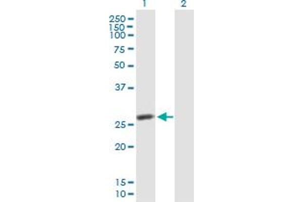 IPP Isomerase 2 Antikörper  (AA 1-227)