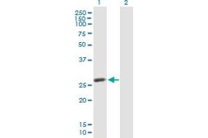 Western Blot analysis of IDI2 expression in transfected 293T cell line by IDI2 MaxPab polyclonal antibody. (IPP Isomerase 2 Antikörper  (AA 1-227))