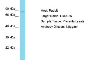 Host: Rabbit Target Name: LRRC36 Sample Type: Placenta lysates Antibody Dilution: 1. (LRRC36 Antikörper  (N-Term))