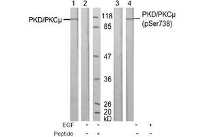 Image no. 1 for anti-Protein Kinase D1 (PRKD1) (Ser738) antibody (ABIN197312) (PKC mu Antikörper  (Ser738))
