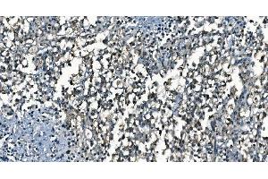 IHC analysis of CDC45L using anti-CDC45L antibody (ABIN7600230). (CDC45 Antikörper  (AA 166-431))