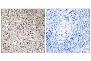 Immunohistochemistry analysis of paraffin-embedded human ovary tissue using GCNT7 antibody. (GCNT7 Antikörper  (C-Term))