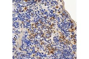 Immunohistochemistry (Paraffin-embedded Sections) (IHC (p)) image for anti-La Ribonucleoprotein Domain Family, Member 1 (LARP1) antibody (ABIN7074453)