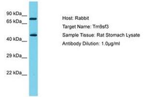 Image no. 1 for anti-Transmembrane 9 Superfamily Member 3 (TM9SF3) (AA 187-236) antibody (ABIN6750318) (TM9SF3 Antikörper  (AA 187-236))