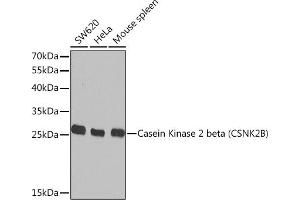 Western blot analysis of extracts of various cell lines, using Casein Kinase 2 beta (Casein Kinase 2 beta (CSNK2B)) Rabbit pAb  at 1:1000 dilution. (CSNK2B Antikörper  (AA 1-215))