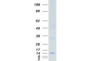 Western Blotting (WB) image for Interferon-Induced Transmembrane Protein 1 (IFITM1) protein (Myc-DYKDDDDK Tag) (ABIN2713514)
