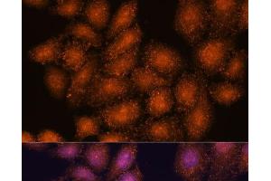 Immunofluorescence analysis of HeLa cells using SMYD3 Polyclonal Antibody at dilution of 1:100. (SMYD3 Antikörper)