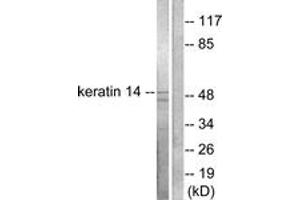 Western blot analysis of extracts from NIH-3T3 cells, using Keratin 14 Antibody. (KRT14 Antikörper  (AA 1-50))