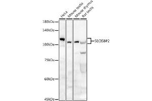 Western blot analysis of extracts of various cell lines, using SECISBP2 antibody (ABIN6128699, ABIN6147497, ABIN6147498 and ABIN6222461) at 1:500 dilution. (SECISBP2 Antikörper  (AA 585-854))