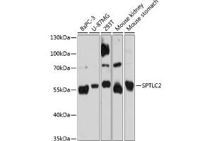 Western blot analysis of extracts of various cell lines, using SPTLC2 Antibody (ABIN6132682, ABIN6148411, ABIN6148412 and ABIN6215412) at 1:3000 dilution. (SPTLC2 Antikörper  (AA 423-562))