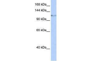 WB Suggested Anti-HELLS Antibody Titration:  0. (HELLS Antikörper  (Middle Region))