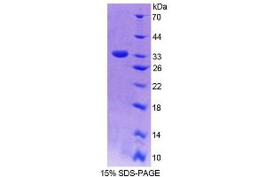SDS-PAGE analysis of Rat NQO1 Protein.