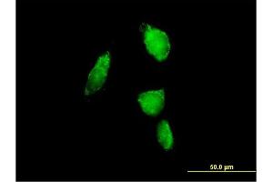 Immunofluorescence of purified MaxPab antibody to PSMA6 on HeLa cell. (PSMA6 Antikörper  (AA 1-246))