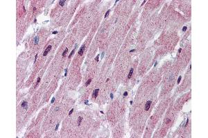 Immunohistochemistry (IHC) image for anti-Spinster Homolog 2 (SPNS2) (N-Term) antibody (ABIN2786494) (SPNS2 Antikörper  (N-Term))