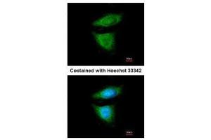 ICC/IF Image Immunofluorescence analysis of methanol-fixed HeLa, using DYNC1I2, antibody at 1:200 dilution. (DYNC1I2 Antikörper)