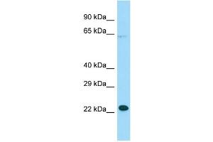 WB Suggested Anti-MOSPD1 Antibody Titration: 1. (MOSPD1 Antikörper  (N-Term))