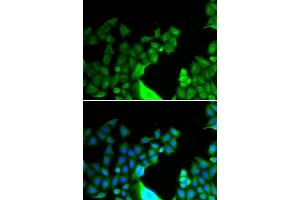 Immunofluorescence analysis of HeLa cells using BCL2L14 antibody (ABIN5973873). (BCL2L14 Antikörper)