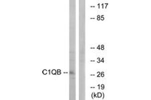 Western blot analysis of extracts from Jurkat cells, using C1QB Antibody. (C1QB Antikörper  (AA 161-210))