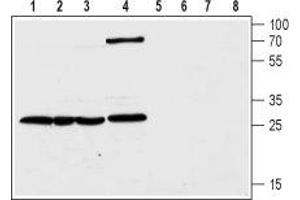 Western blot analysis of human colorectal adenocarcinoma HT-29 (lanes 1 and 5), transplantable human carcinoma cell line T-84 (lanes 2 and 6), human pancreatic carcinoma PANC-1 (lanes 3 and 7) and rat kidney (lanes 4 and 8) lysates: - 1-4. (CLIC1 Antikörper  (C-Term, Intracellular))