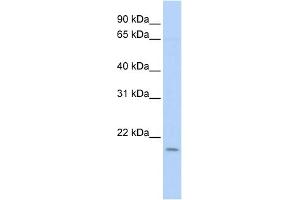 WB Suggested Anti-POLE3 Antibody Titration: 0. (POLE3 Antikörper  (N-Term))