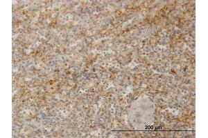 Immunoperoxidase of monoclonal antibody to ZYX on formalin-fixed paraffin-embedded human spleen. (ZYX Antikörper  (AA 1-572))