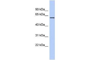 WB Suggested Anti-PDE4B Antibody Titration: 0. (PDE4B Antikörper  (Middle Region))
