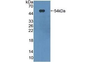 Detection of Recombinant ITGaX, Mouse using Polyclonal Antibody to Integrin Alpha X (CD11c) (CD11c Antikörper  (AA 907-1115))