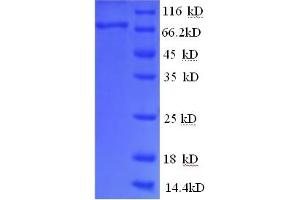 SDS-PAGE (SDS) image for Glucose-6-Phosphate Isomerase (G6PI) (AA 2-554), (partial) protein (His tag) (ABIN5712051) (G6PI Protein (AA 2-554, partial) (His tag))