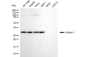 Western blotting analysis using sirtuin 5 antibody (ABIN7800355). (SIRT5 Antikörper)