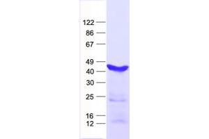 Validation with Western Blot (STRADA Protein (His tag))