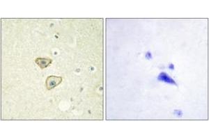 Immunohistochemistry (IHC) image for anti-Epidermal Growth Factor Receptor (EGFR) (AA 986-1035) antibody (ABIN2888655) (EGFR Antikörper  (AA 986-1035))