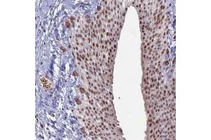 Immunohistochemical staining of human urinary bladder with MFAP1 polyclonal antibody  shows moderate nuclear positivity in urothelial cells at 1:2500-1:5000 dilution. (MFAP1 Antikörper)