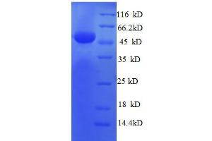 Ribosomal Protein L8 (RPL8) (AA 3-257), (partial) protein (GST tag) (RPL8 Protein (AA 3-257, partial) (GST tag))
