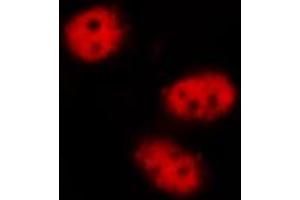 ABIN6267502 staining LOVO by IF/ICC. (STAT3 Antikörper  (pTyr705))