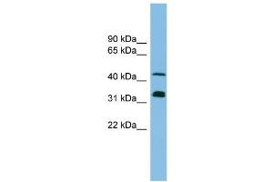 WB Suggested Anti-GORASP1 Antibody Titration: 0.