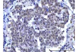 IHC analysis of RBM15B using anti-RBM15B antibody (ABIN7600219).