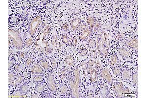 Formalin-fixed and paraffin embedded human stomach tissue labeled with Anti-MACC1Polyclonal Antibody, Unconjugated (ABIN706526) followed by conjugation to the secondary antibody and DAB staining (MACC1 Antikörper  (AA 761-852))