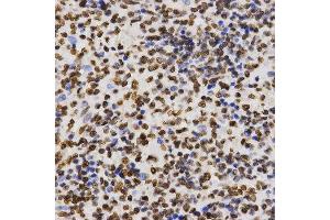 Immunohistochemistry of paraffin-embedded human kidney tissue using H3K27me2 antibody at dilution of 1:200 (x400 lens). (Histone 3 Antikörper  (H3K27me))