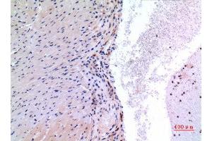 Immunohistochemistry (IHC) analysis of paraffin-embedded Mouse Heart, antibody was diluted at 1:100. (VEGFC Antikörper  (Internal Region))