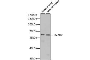 Western blot analysis of extracts of various cell lines, using SMAD2 antibody (ABIN4905224) at 1:1000 dilution. (SMAD2 Antikörper)