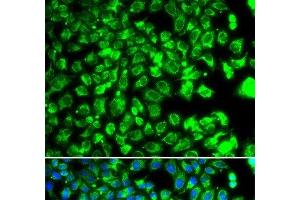 Immunofluorescence analysis of MCF-7 cells using C10orf32 Polyclonal Antibody (C10ORF32 Antikörper)