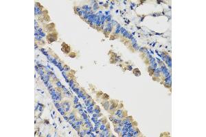 Immunohistochemistry of paraffin-embedded mouse lung using IL36G antibody (ABIN5974550) at dilution of 1/100 (40x lens). (IL1F9 Antikörper)