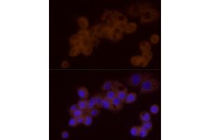 Immunofluorescence analysis of HepG2 cells using DTYMK Rabbit mAb (ABIN7266735) at dilution of 1:25 (40x lens). (DTYMK Antikörper)