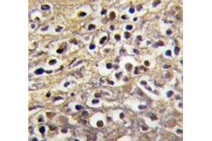 Immunohistochemistry (IHC) image for anti-Cytochrome P450, Family 19, Subfamily A, Polypeptide 1 (CYP19A1) (AA 453-485) antibody (ABIN3028608)