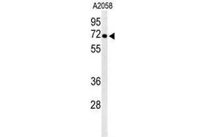 Western blot analysis of ATP6V1A Antibody (Center) in A2058 cell line lysates (35µg/lane).